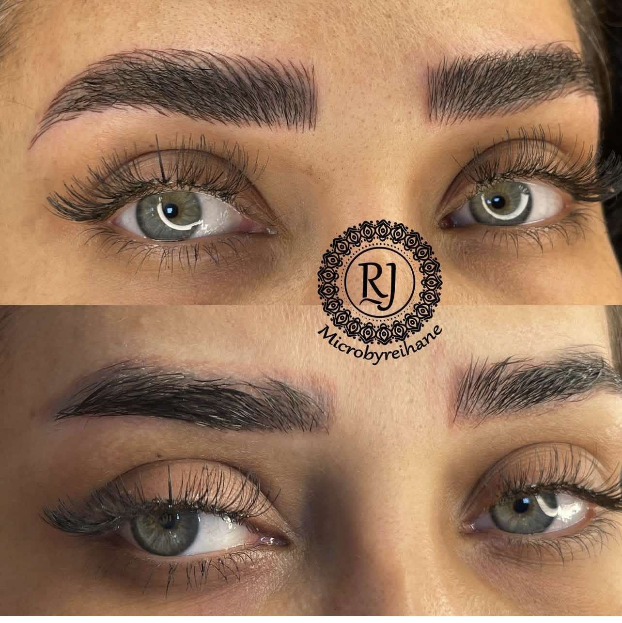 میکروبلیدینگ